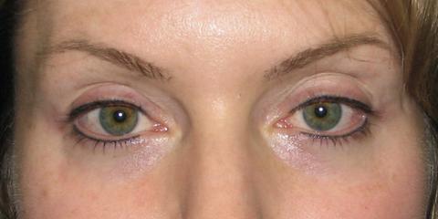 Eyeliner permanent cosmetics, after photo