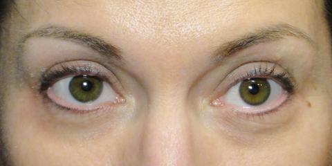 Eyeliner permanent cosmetics, before photo