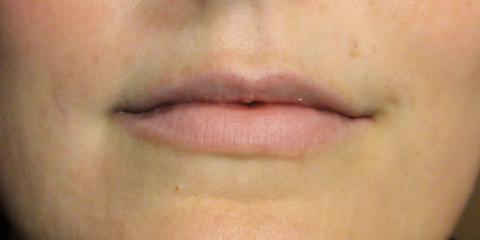 Lips permanent cosmetics, before photo