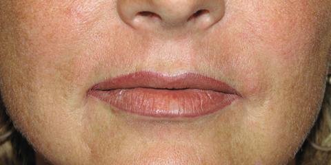 Lips permanent cosmetics, after photo