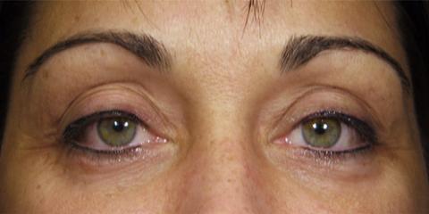 Eyeliner permanent cosmetics, after photo
